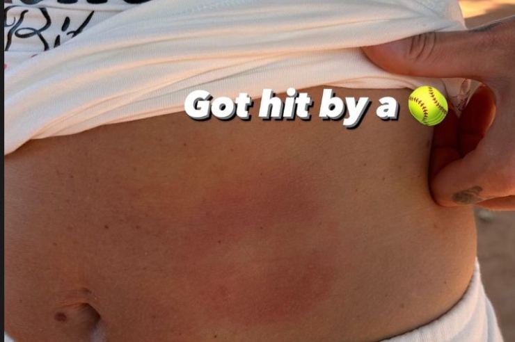 Ferragni, finisce male la partita di tennis: ferite sul corpo